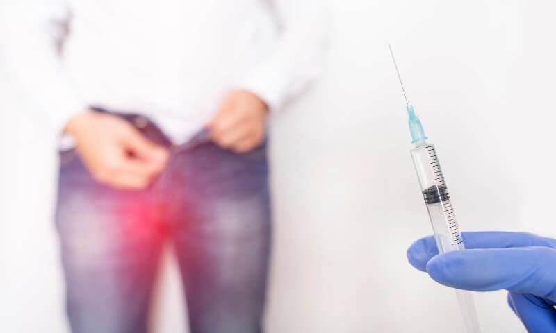 Infertilidad Reversible y Varicocele